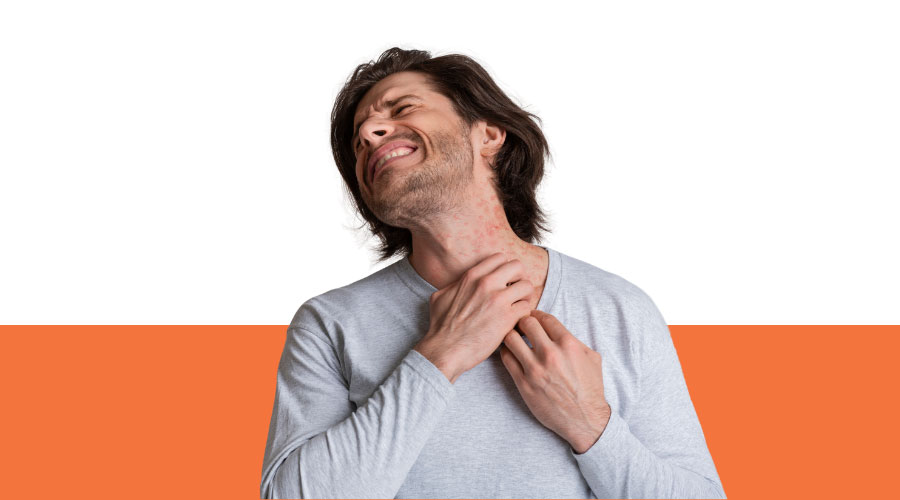 Understanding Eczema: Effective Strategies for Managing Symptoms and Preventing Flare-Ups