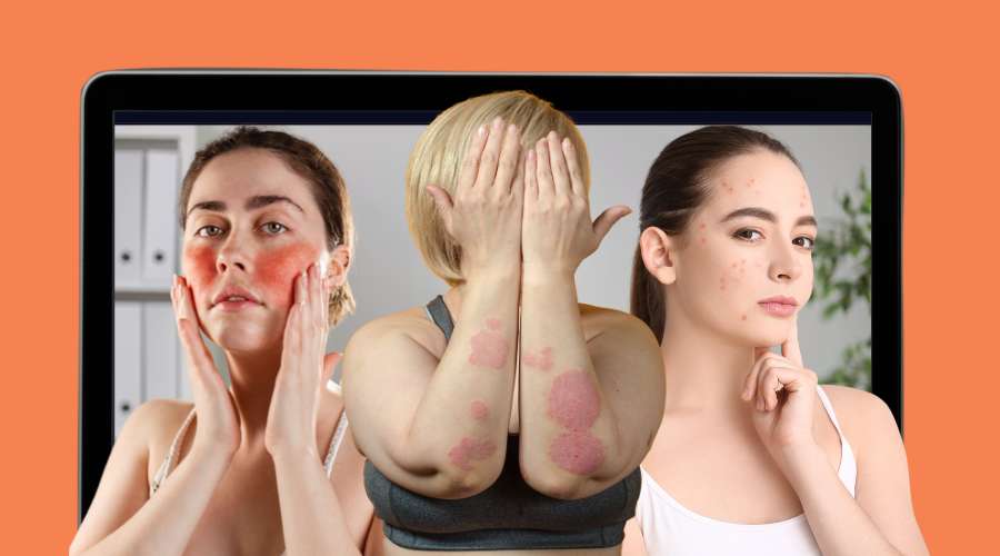 Common skin issues addressed through telehealth dermatology