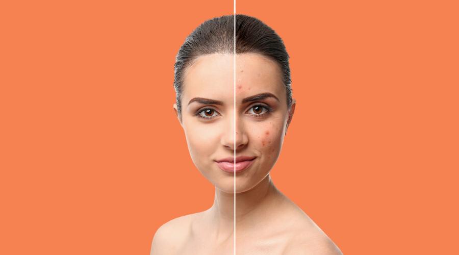 Early Diagnosis and Treatment: The Key to Managing Skin Conditions