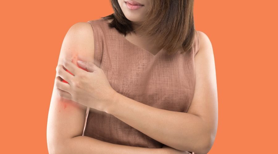 Living with Psoriasis: Effective Treatment Options and Lifestyle Changes