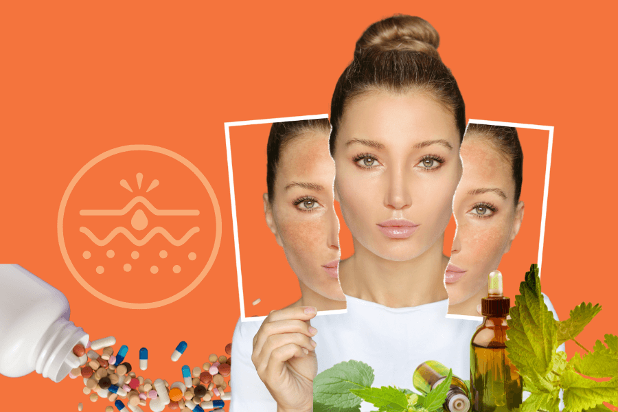 Acne, eczema, and psoriasis: understanding the most common skin conditions and how to treat them