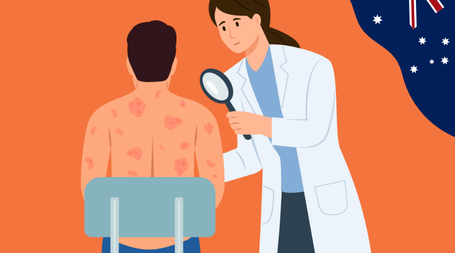 Managing eczema flare-ups in Australia: A dermatologist’s guide