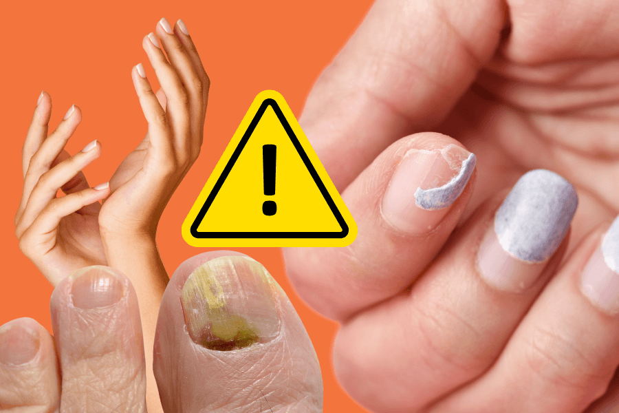What your nails are telling you about your health: 7 warning signs