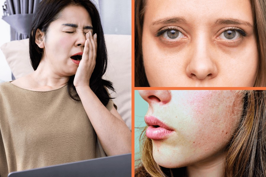 Lack of Sleep Effects on Skin: 7 Ways Poor Rest Ages Your Complexion
