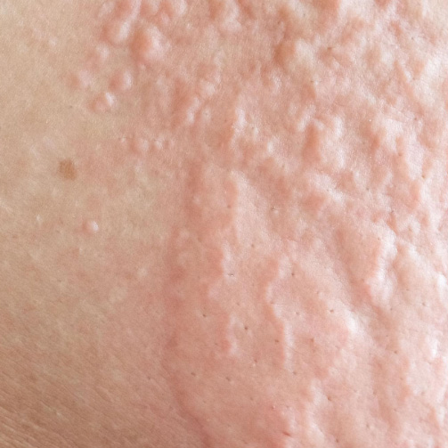 close up hive