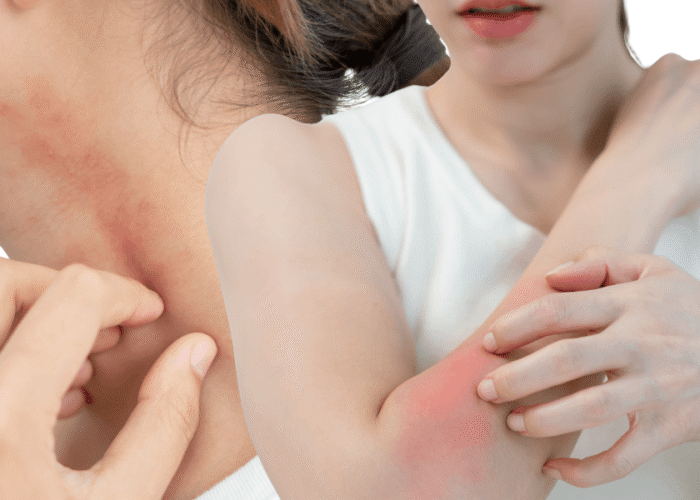 Persistent itchy skin that won't respond to creams? Consult an AHPRA-registered dermatologist online at Dermo Direct — no referral, no waitlist.