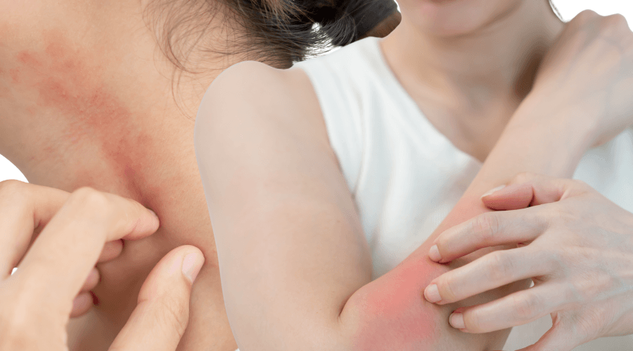 Persistent itchy skin that won't respond to creams? Consult an AHPRA-registered dermatologist online at Dermo Direct — no referral, no waitlist.