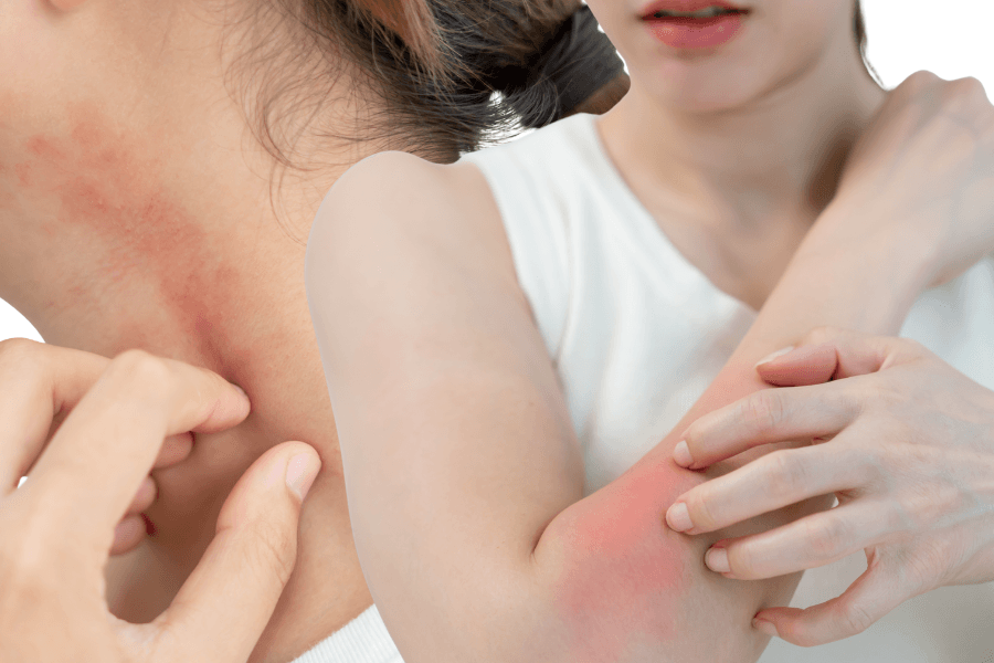 Persistent itchy skin that won't respond to creams? Consult an AHPRA-registered dermatologist online at Dermo Direct — no referral, no waitlist.